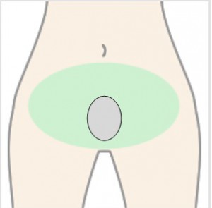 卵型