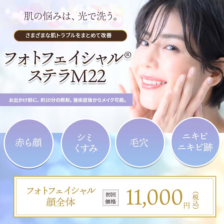 ステラM22 フォトフェイシャル