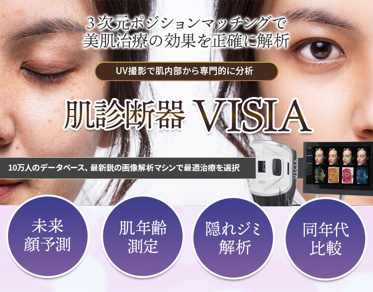 肌診断器 VISIA