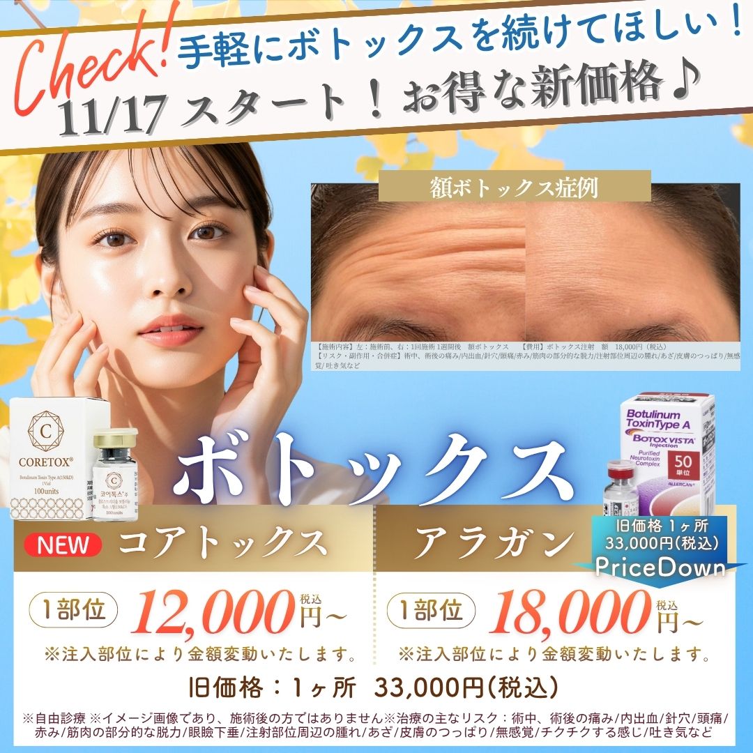 ボトックス注射