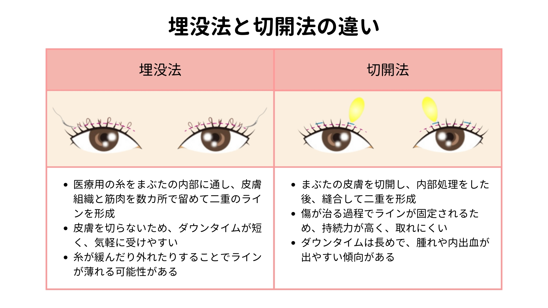 二重　埋没法　切開法　比較