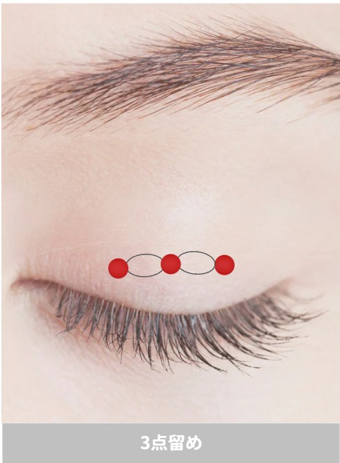 埋没二重　3点留め　画像