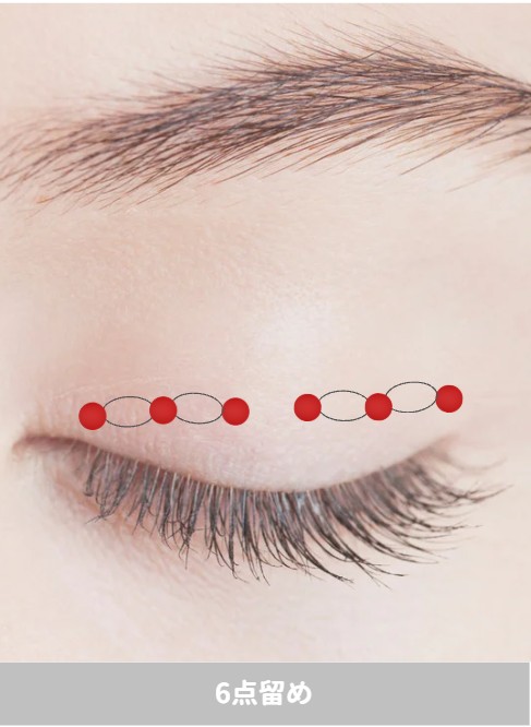 埋没二重　6点留め　画像