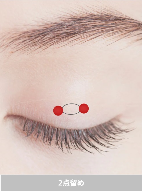 埋没二重　2点留め