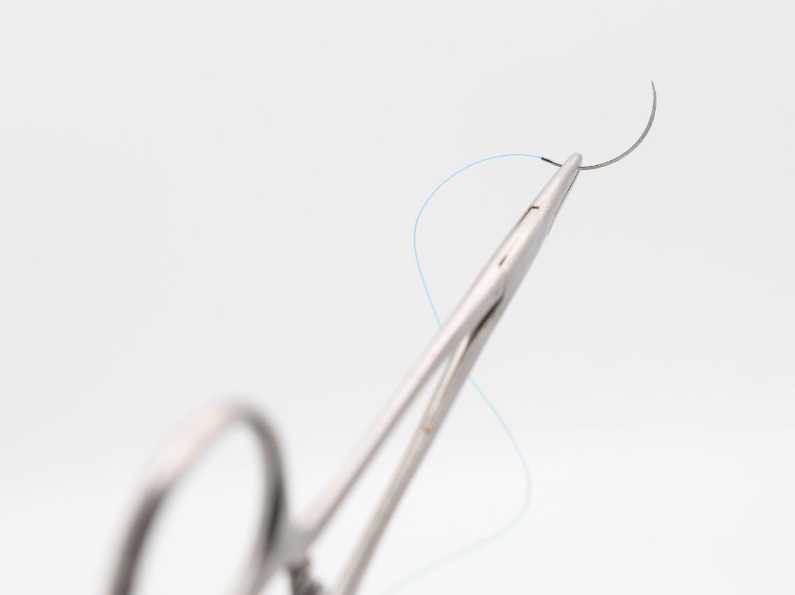 小陰唇縮小術 縫合 イメージ画像